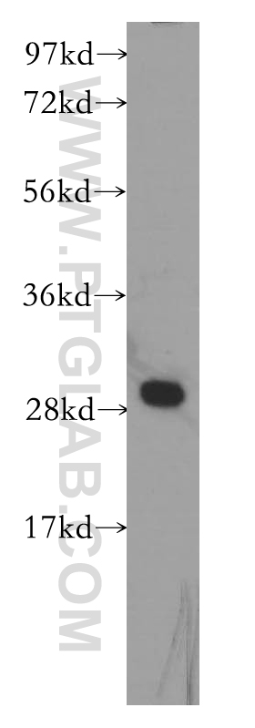 WB analysis of K-562 using 11860-1-AP