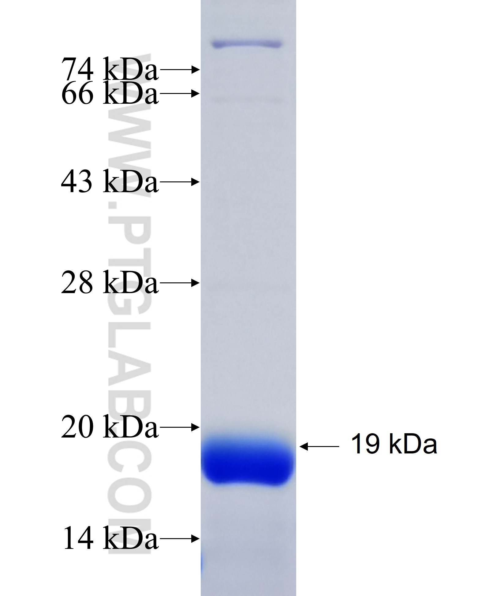 DLEU7 fusion protein Ag35005 SDS-PAGE DLEU7 fusion protein Ag35005 SDS-PAGE
