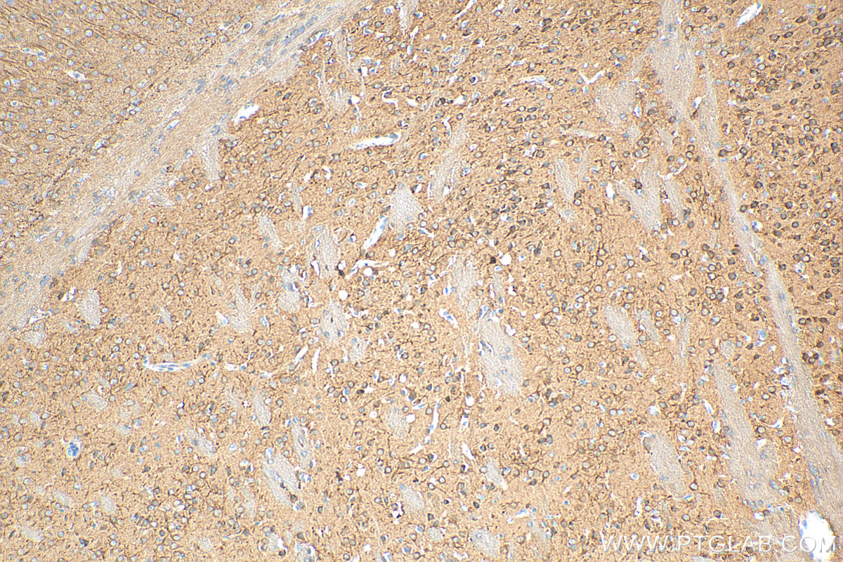 IHC staining of mouse brain using 18036-1-AP