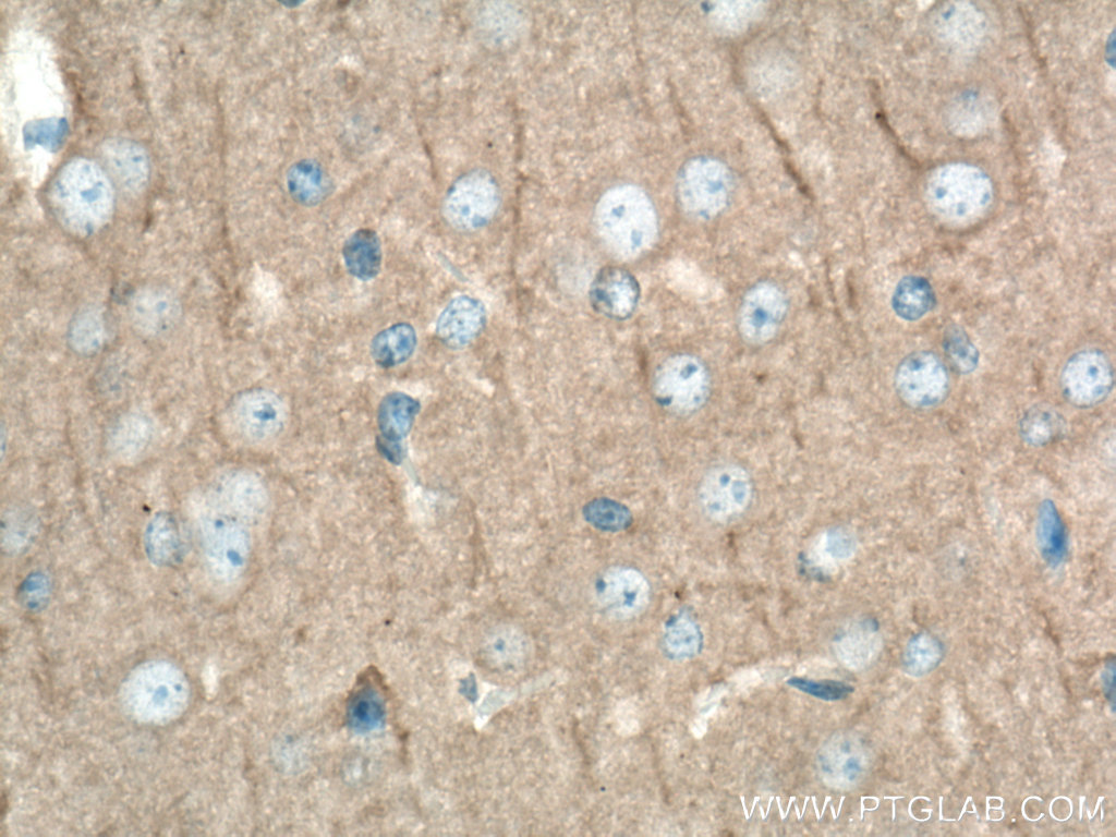 IHC staining of mouse brain using 67102-1-Ig (same clone as 67102-1-PBS)