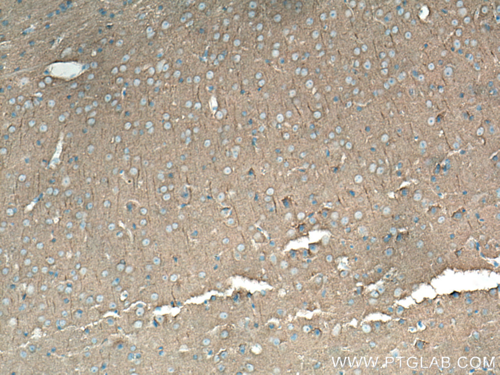 IHC staining of mouse brain using 67102-1-Ig