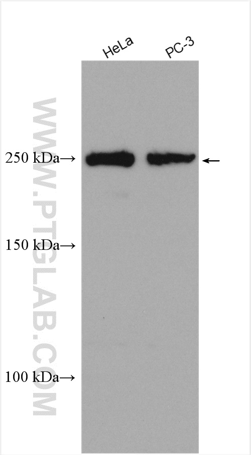 WB analysis using 15687-1-AP