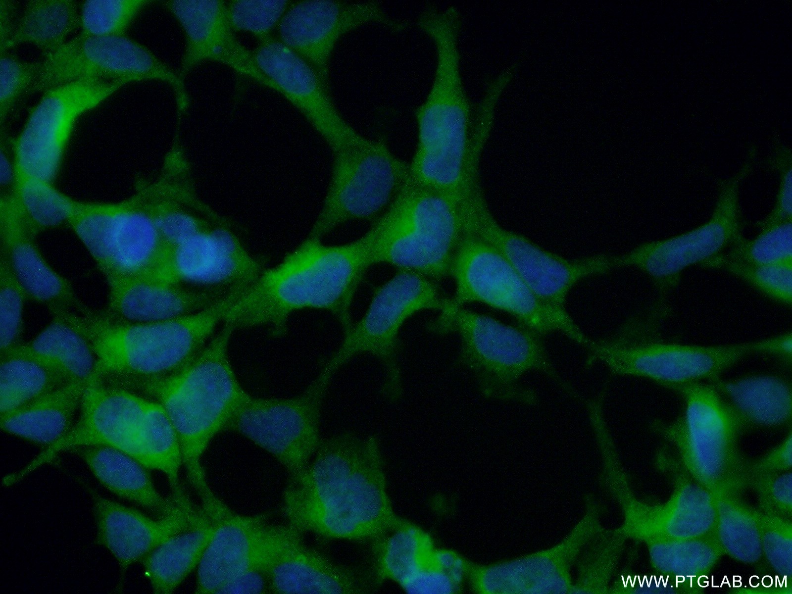 IF Staining of HEK-293 using 12038-1-AP