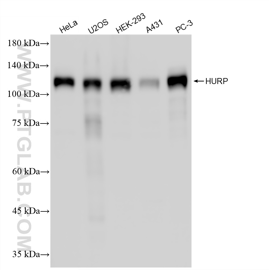Various lysates were subjected to SDS PAGE followed by western blot with 12038-1-AP (HURP antibody) at dilution of 1:1000 incubated at room temperature for 1.5 hours. WB analysis using 12038-1-AP