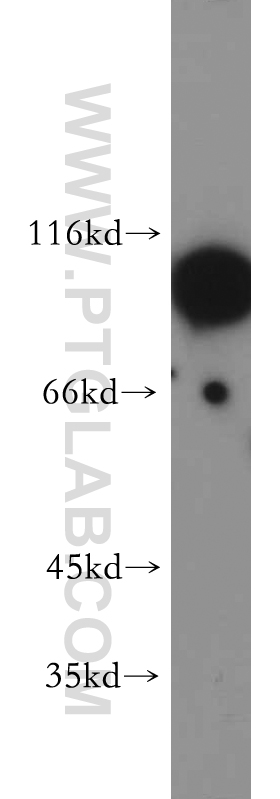 WB analysis of HEK-293 using 12038-1-AP