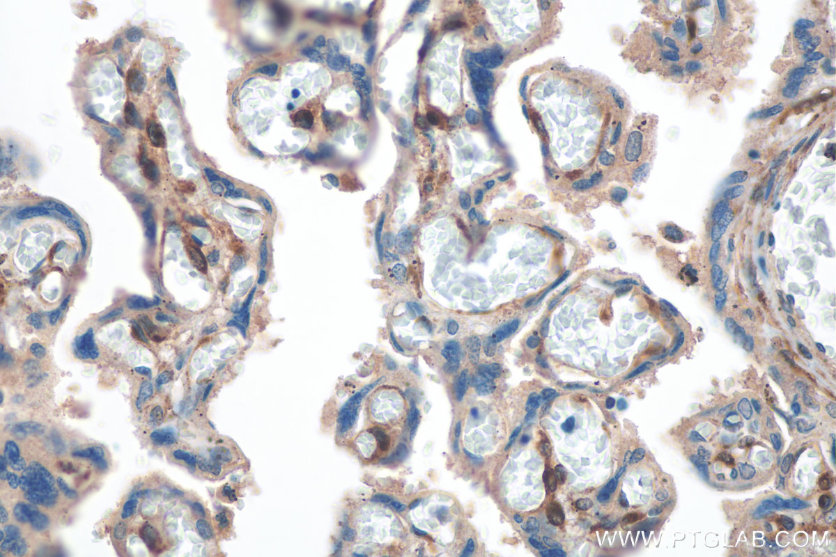 IHC staining of human placenta using 29288-1-AP (same clone as 29288-1-PBS)
