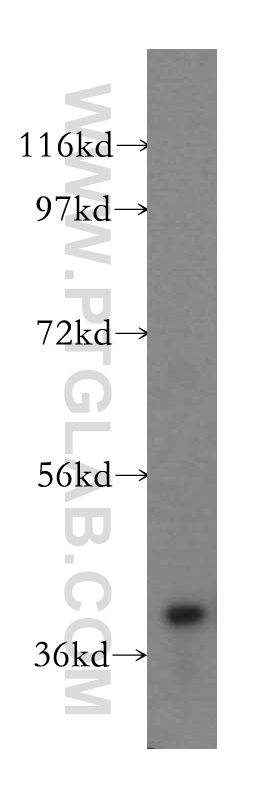 WB analysis of mouse brain using 15680-1-AP