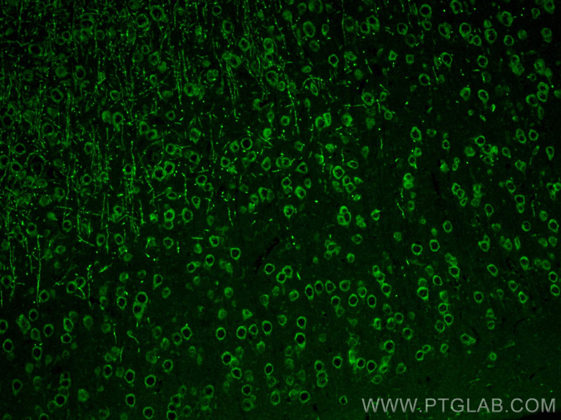 IF Staining of mouse brain using 25535-1-AP