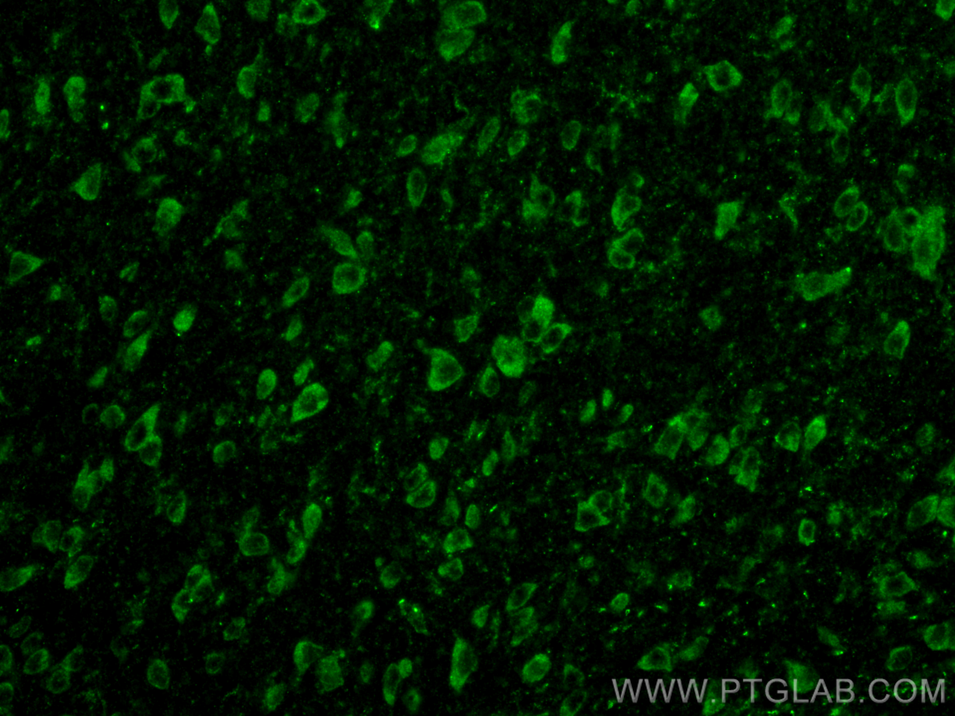 IF Staining of mouse brain using 25535-1-AP