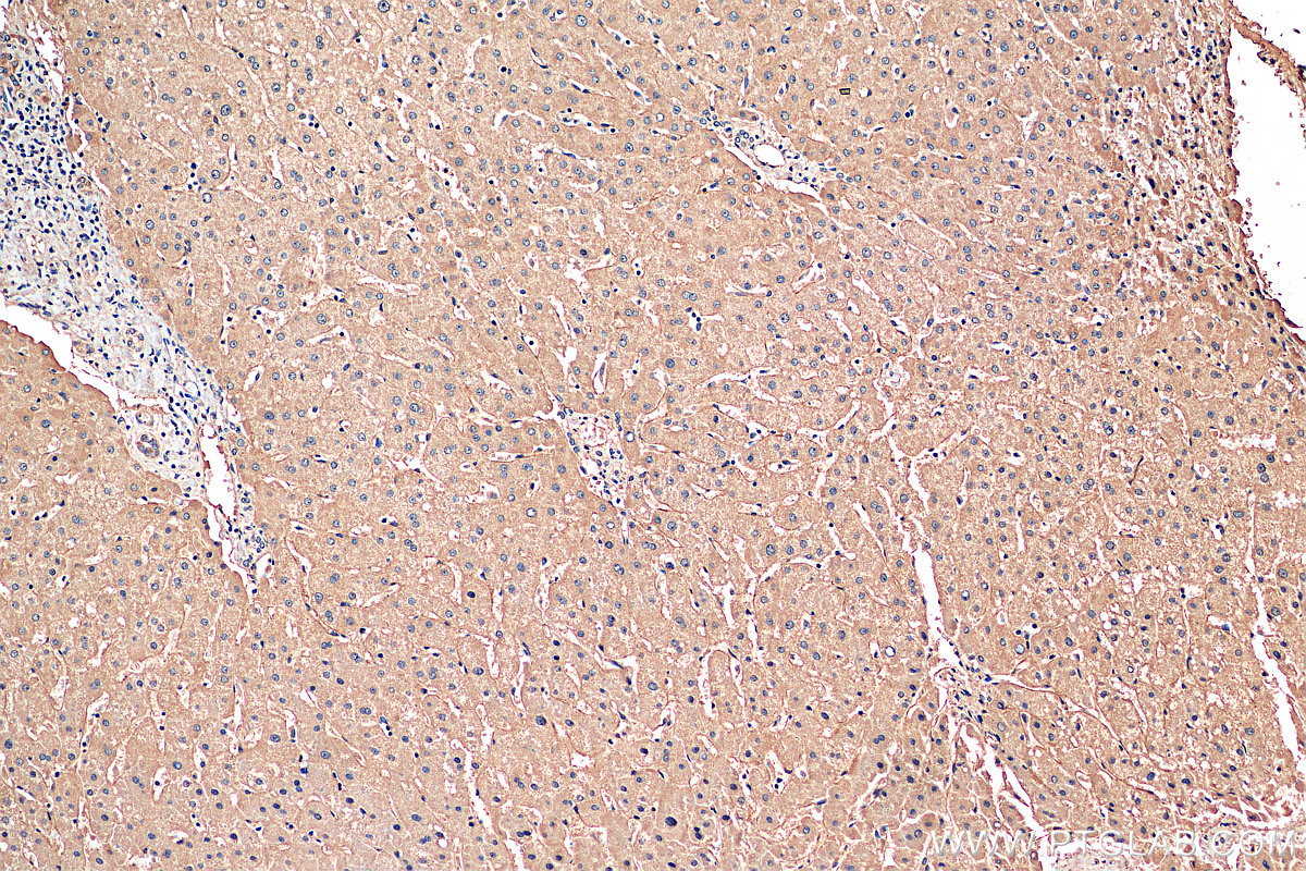 IHC staining of human liver using 25535-1-AP