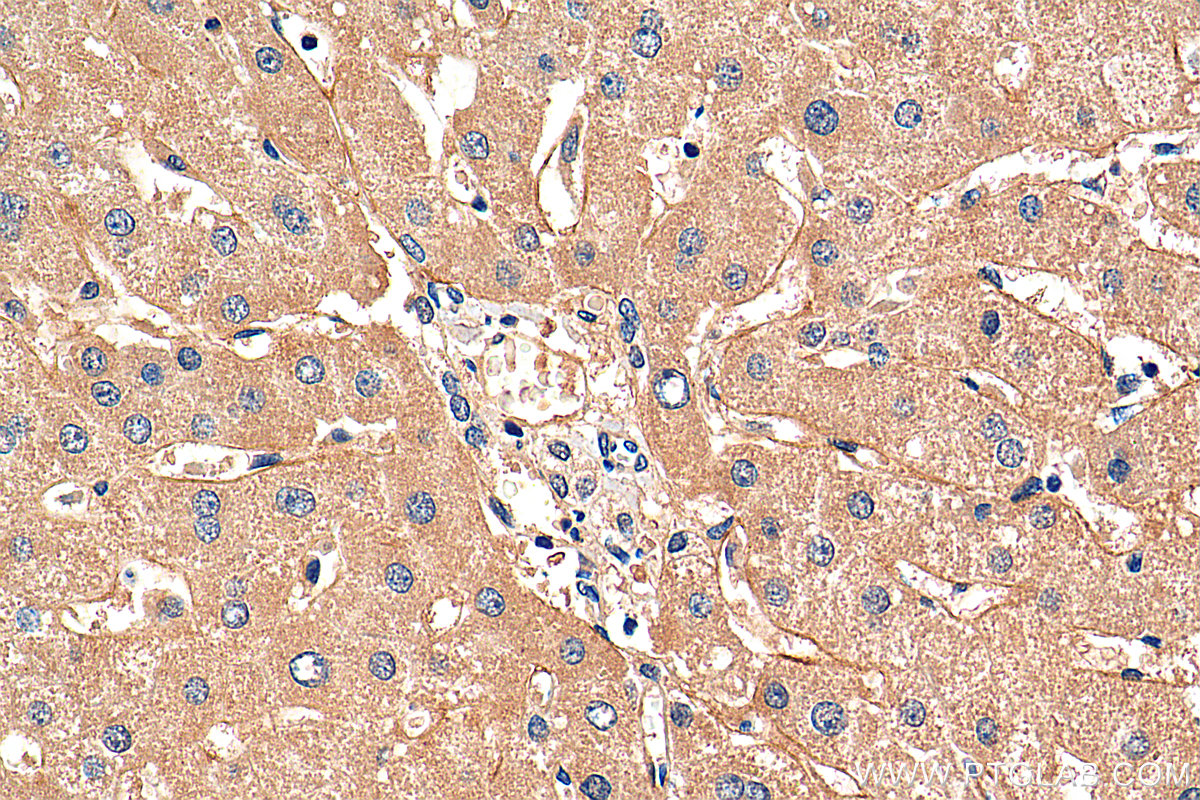 IHC staining of human liver using 25535-1-AP