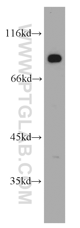 DLL4 Polyclonal antibody