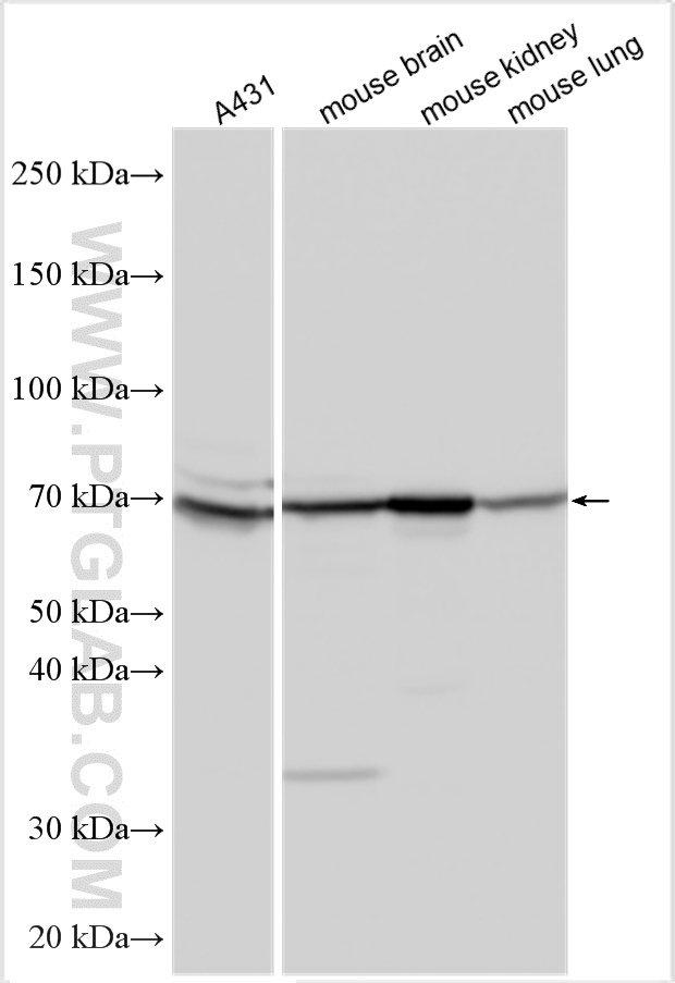WB analysis using 32331-1-AP