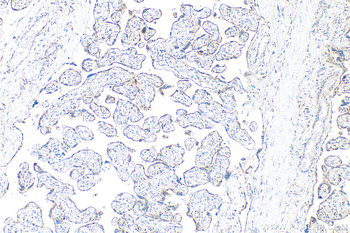 IHC staining of human placenta using 31174-1-AP