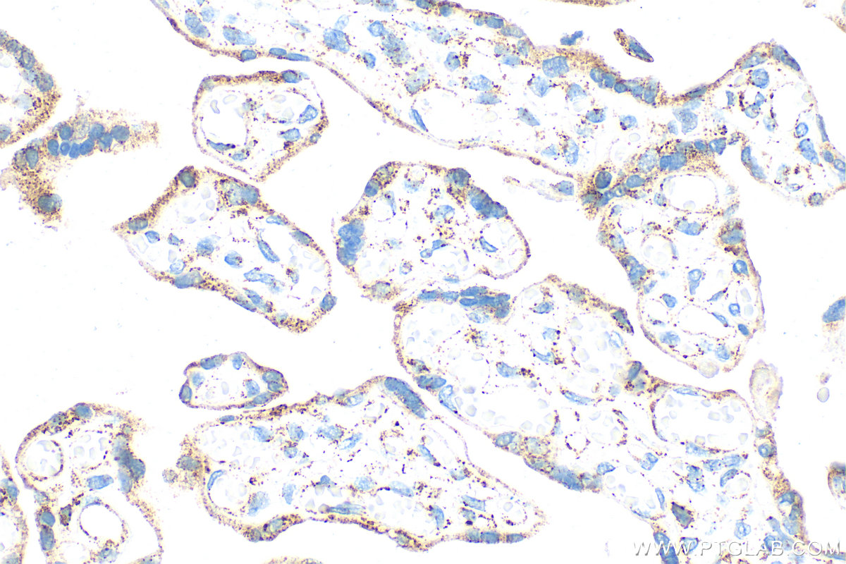 IHC staining of human placenta using 31174-1-AP