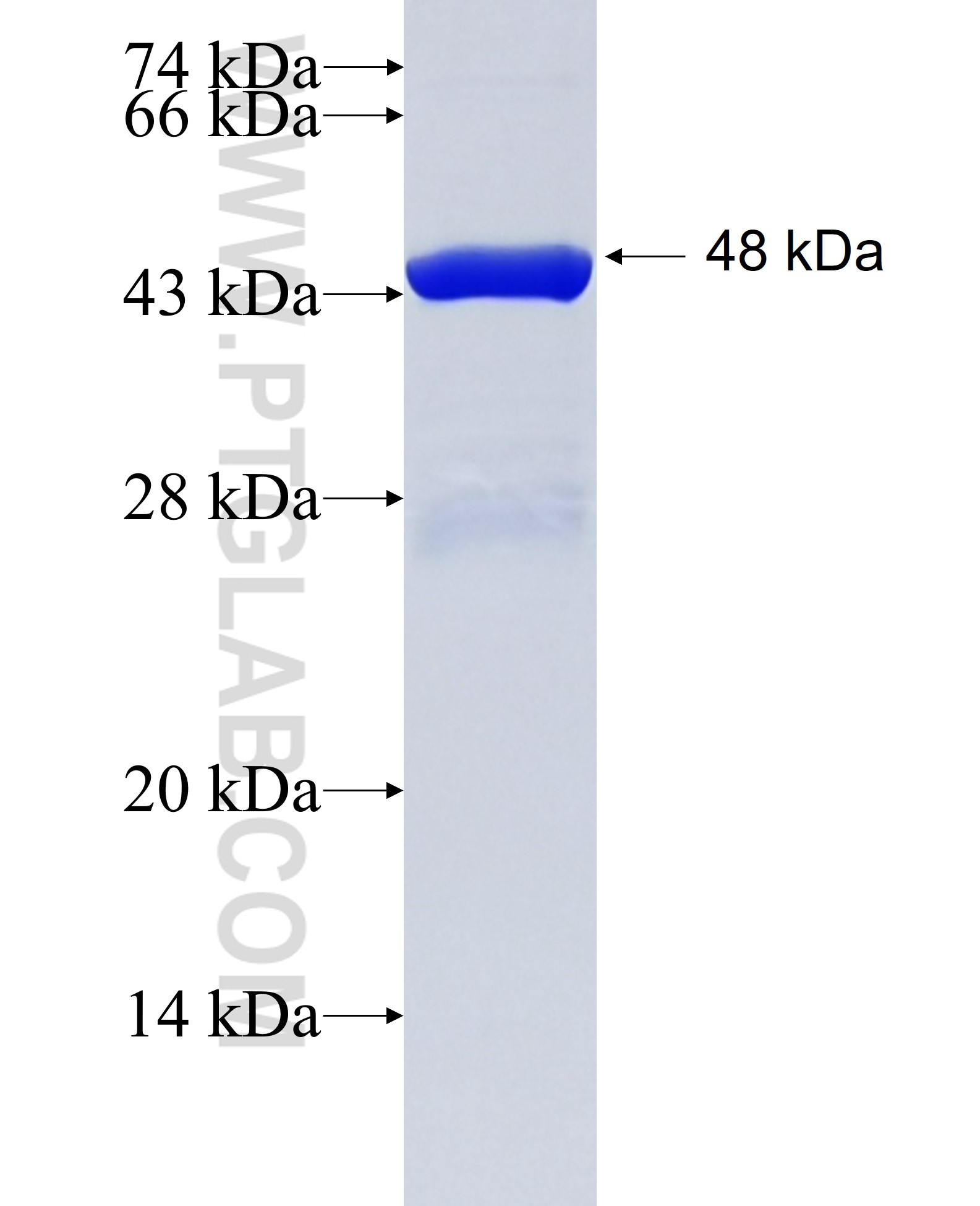 DLST fusion protein Ag34753 SDS-PAGE DLST fusion protein Ag34753 SDS-PAGE