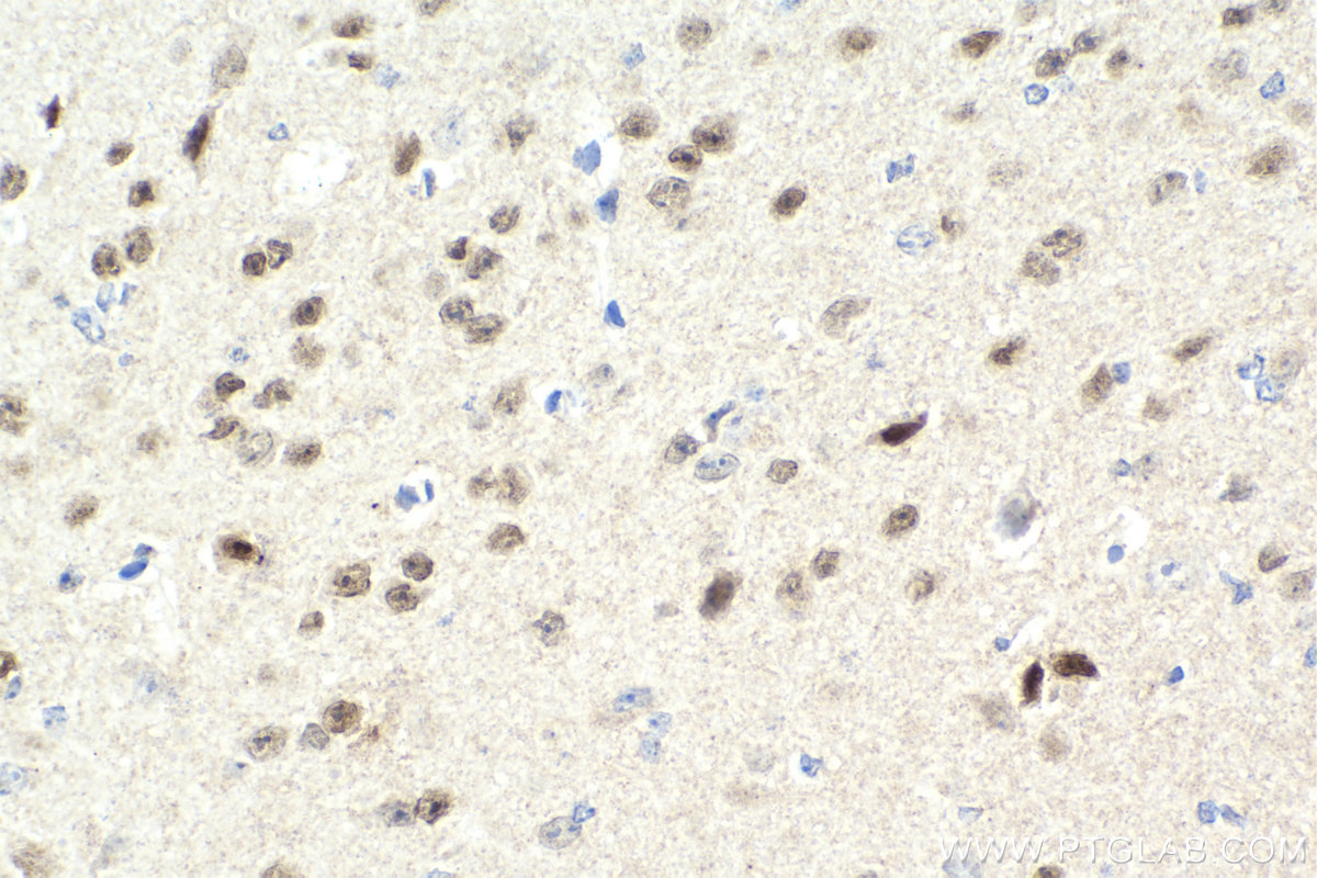 IHC staining of mouse brain using 13046-1-AP