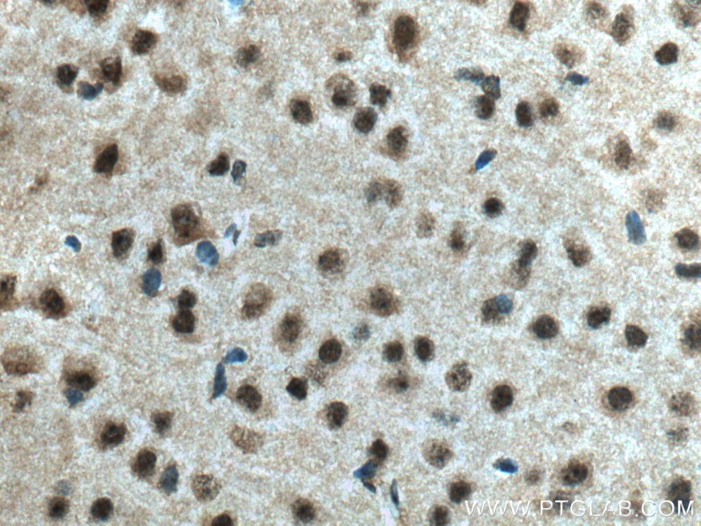 IHC staining of mouse brain using 26244-1-AP