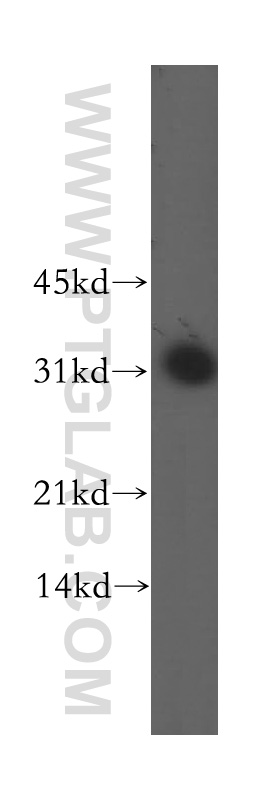 DLX3 Polyclonal antibody