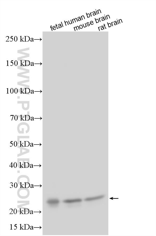 WB analysis using 10592-1-AP