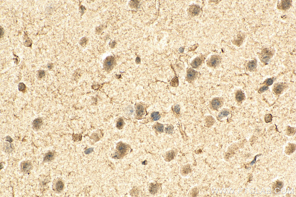 IHC staining of mouse brain using 67111-1-Ig