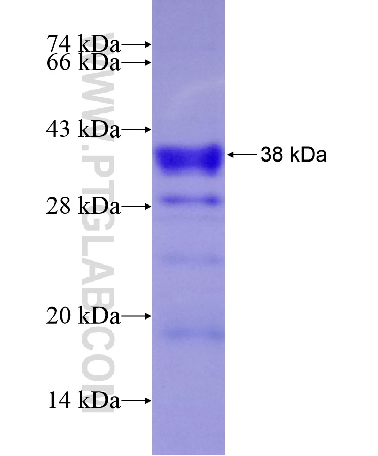 DLX5 fusion protein Ag17040 SDS-PAGE