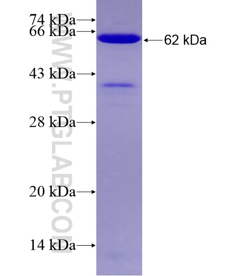 DMAP1 fusion protein Ag28906 SDS-PAGE