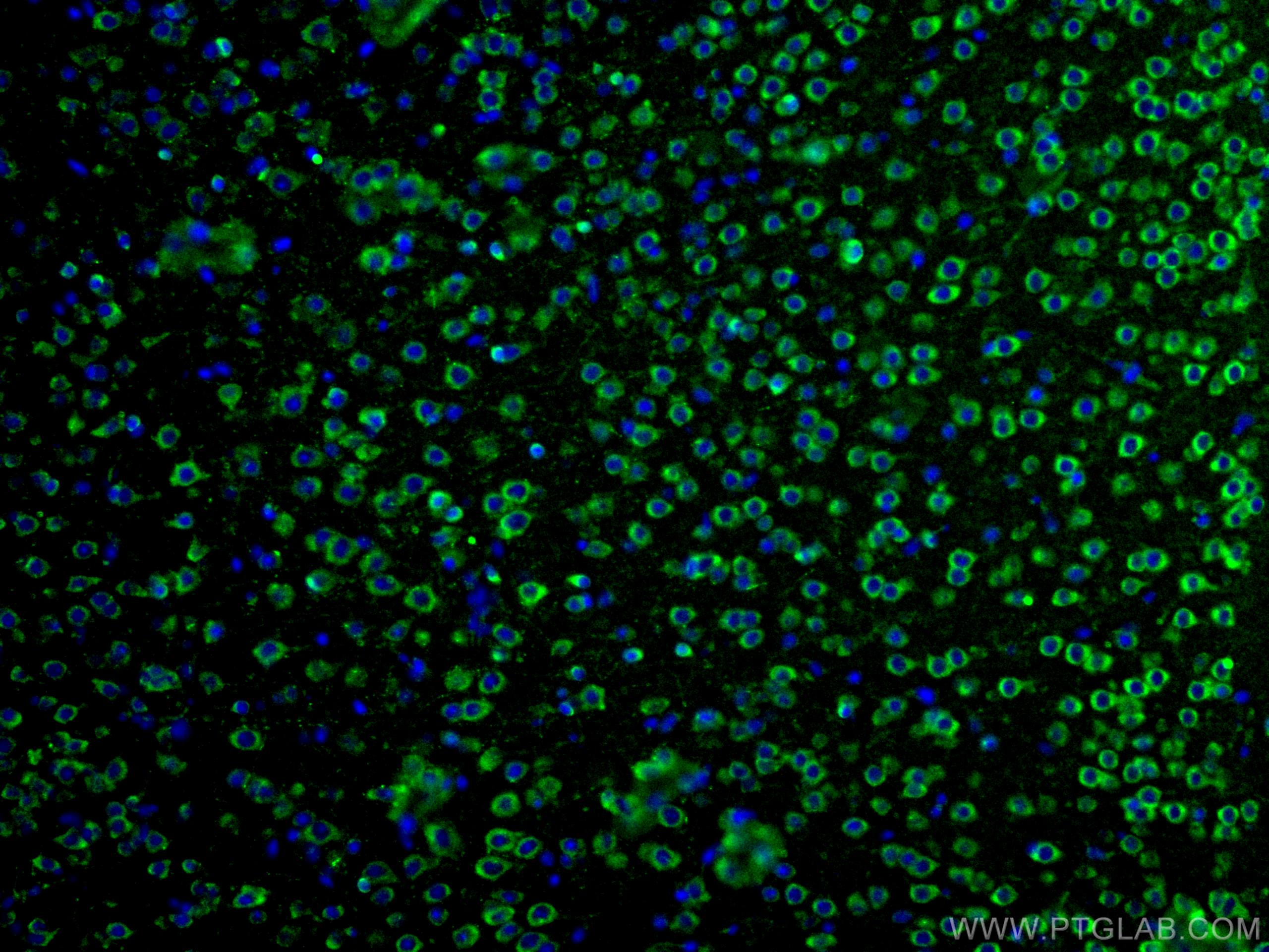 IF Staining of human brain using 27069-1-AP