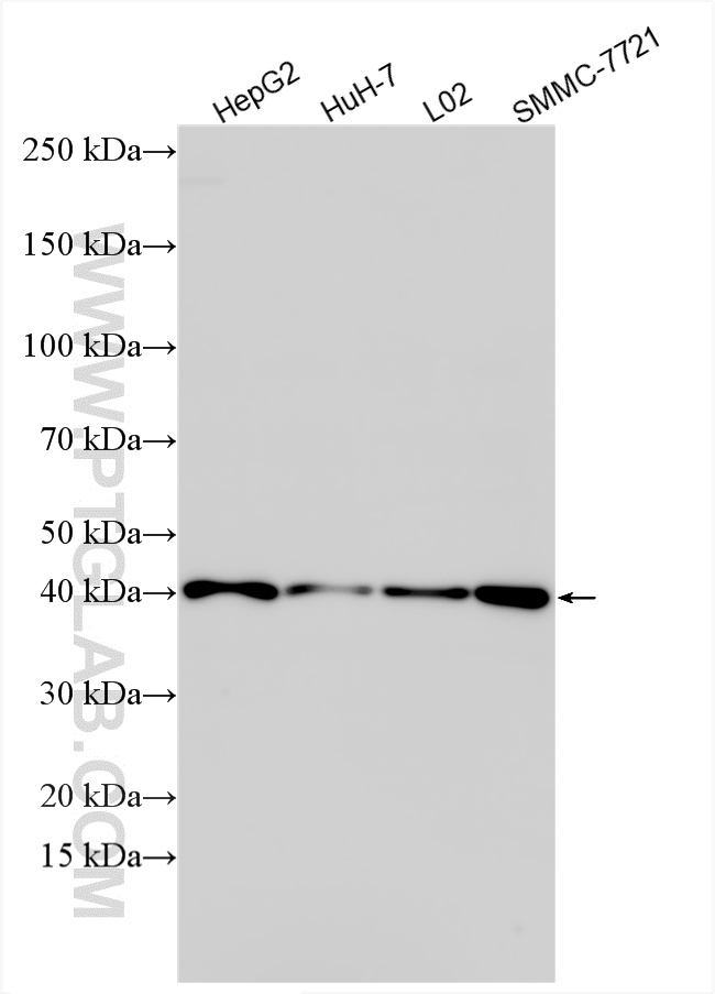 WB analysis using 33988-1-AP WB analysis using 33988-1-AP