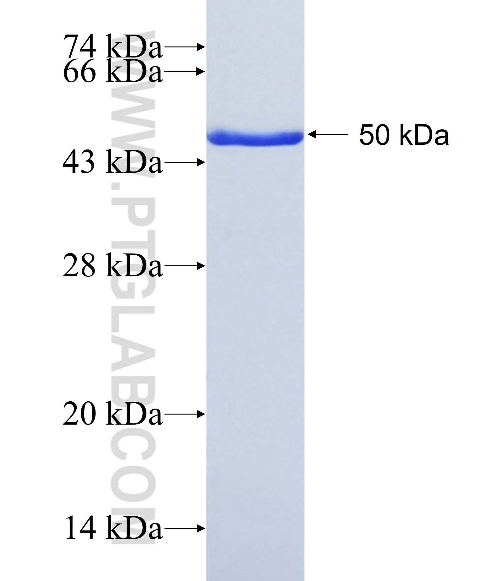DMBX1 fusion protein Ag41356 SDS-PAGE DMBX1 fusion protein Ag41356 SDS-PAGE