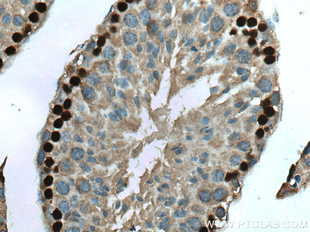 IHC staining of mouse testis using 67176-1-Ig (same clone as 67176-1-PBS)