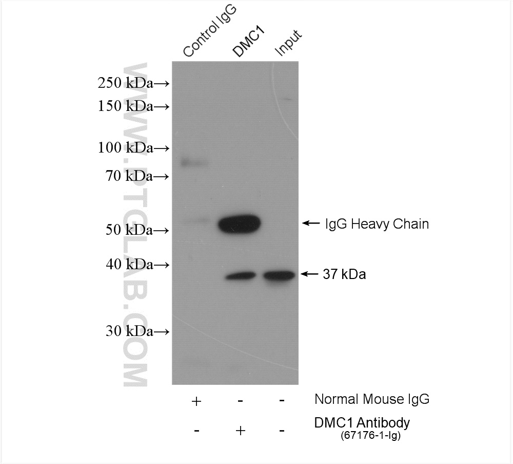 IP experiment of mouse testis using 67176-1-Ig (same clone as 67176-1-PBS)