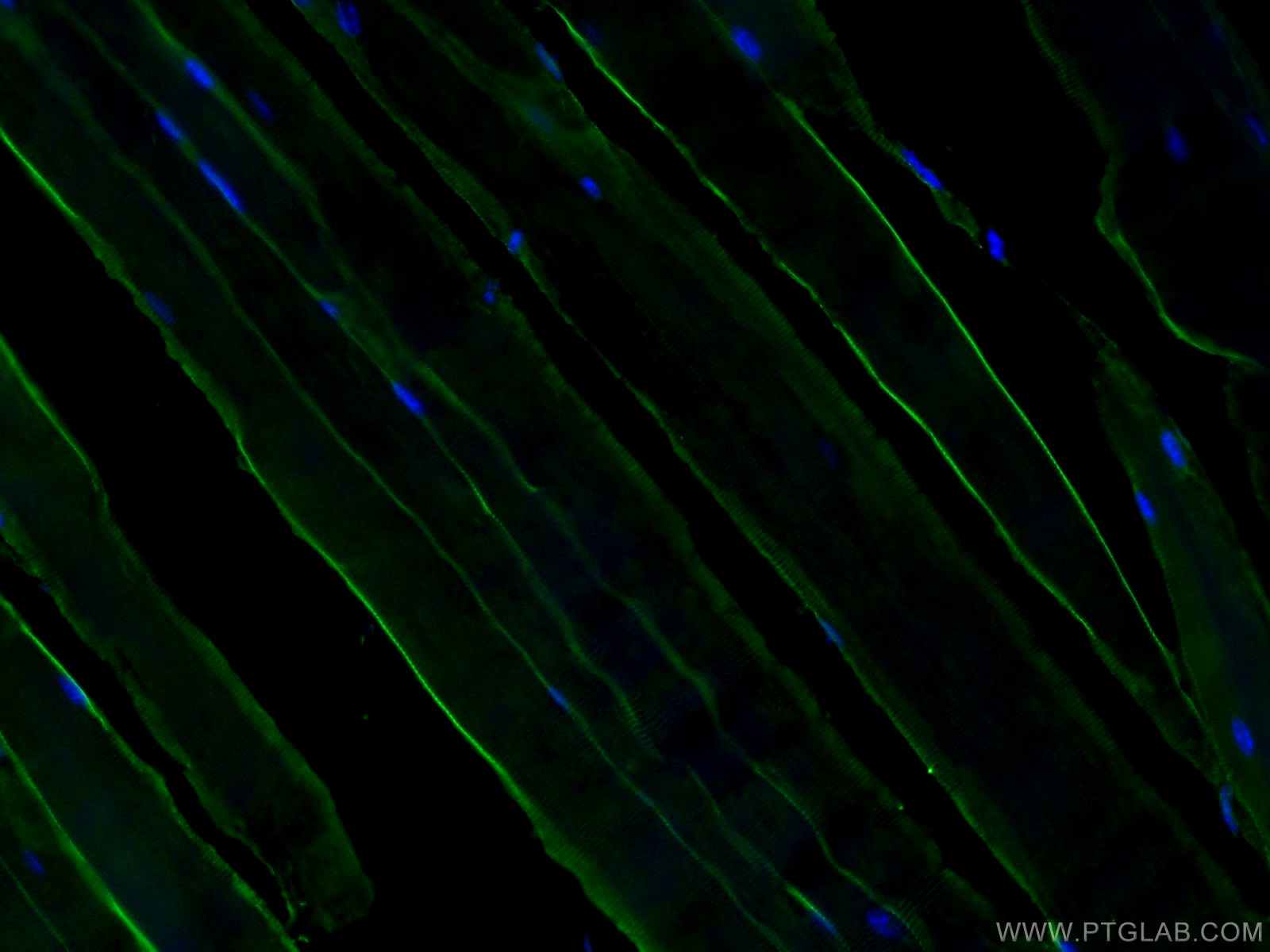 Dystrophin