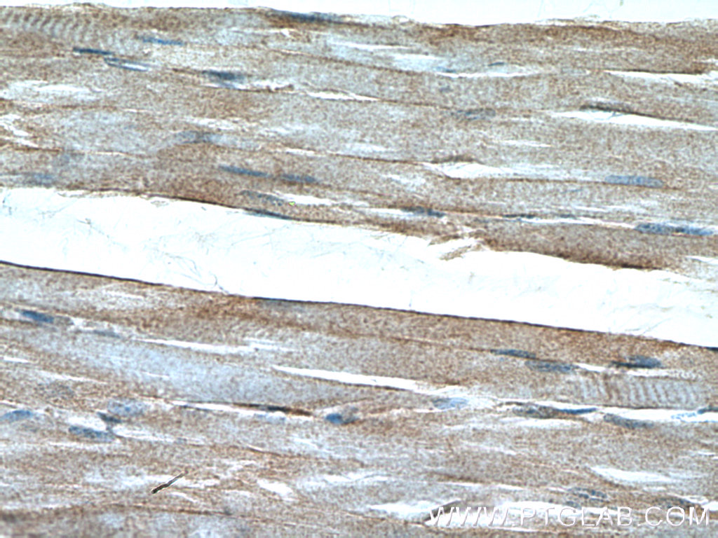 IHC staining of human skeletal muscle using 12715-1-AP