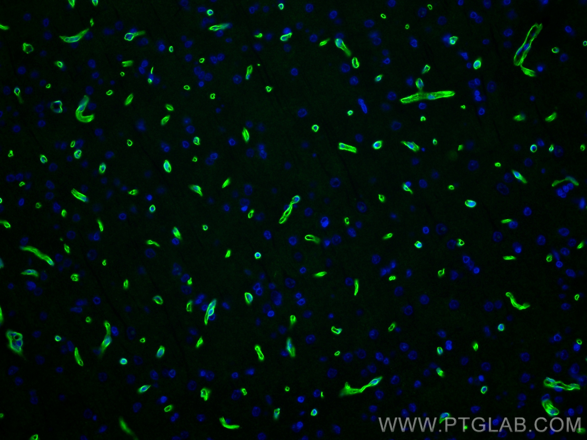 IF Staining of rat brain using 83609-6-RR