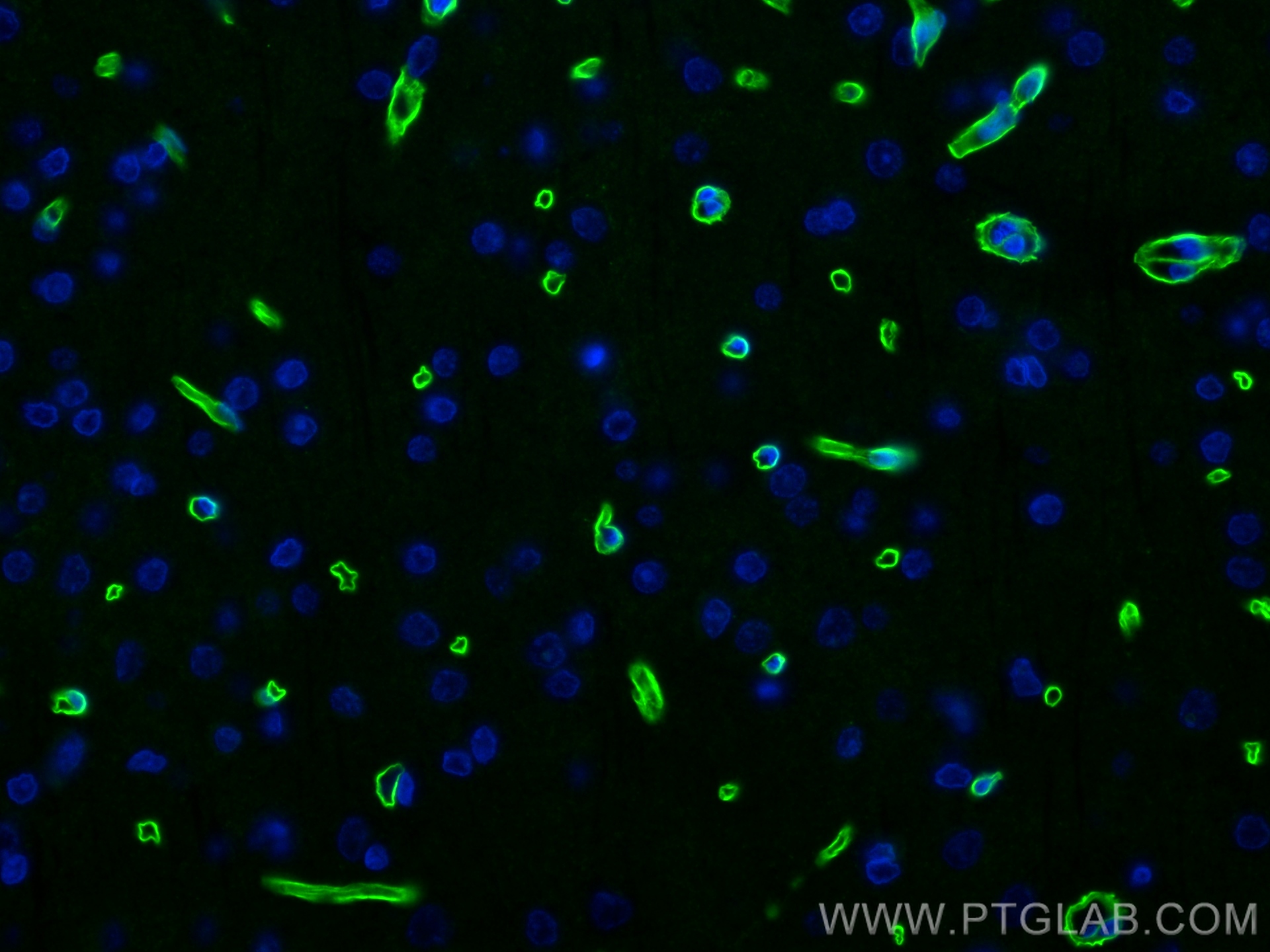 IF Staining of rat brain using 83609-6-RR