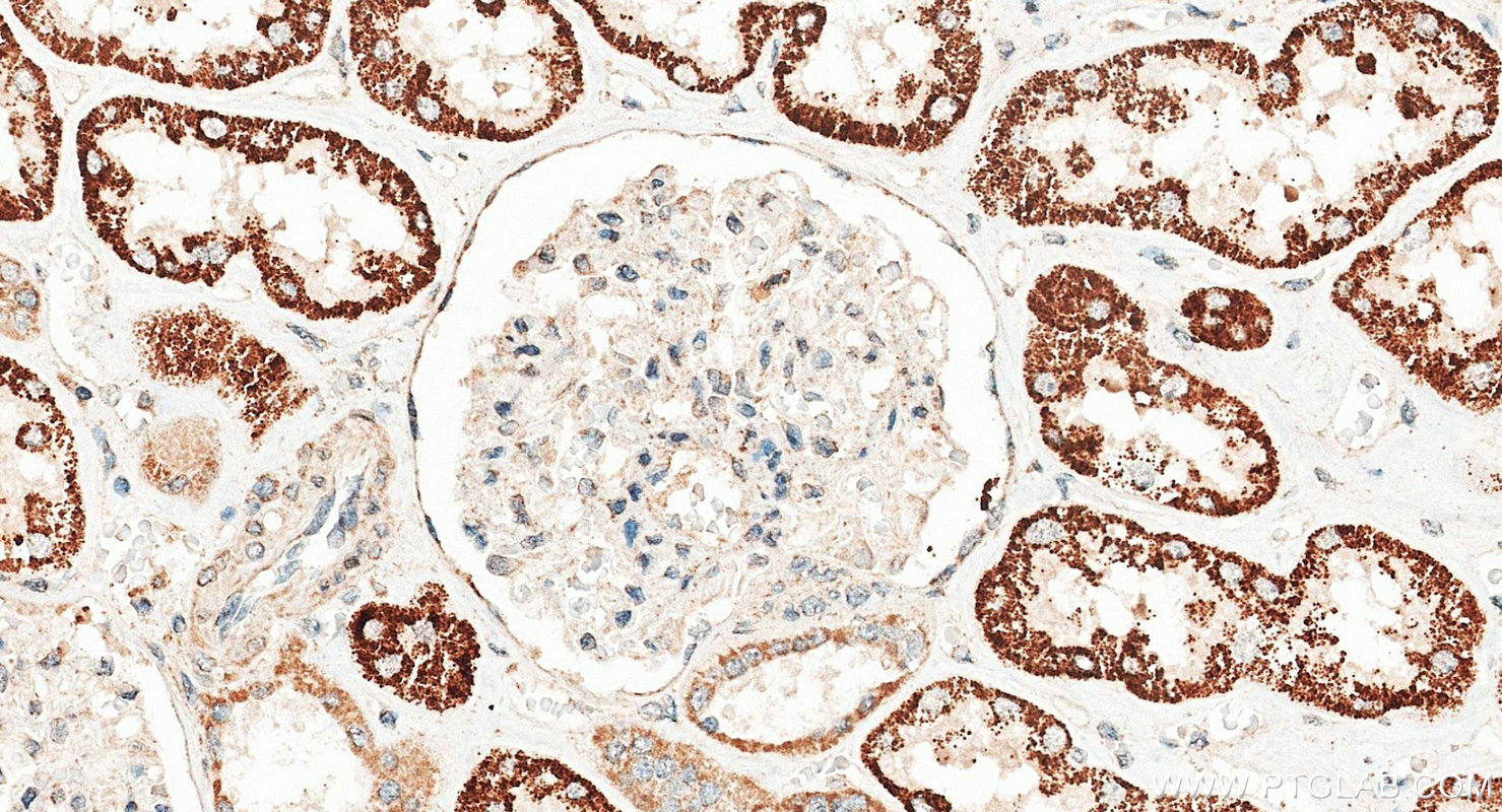 IHC staining of human kidney using 24813-1-AP IHC staining of human kidney using 24813-1-AP