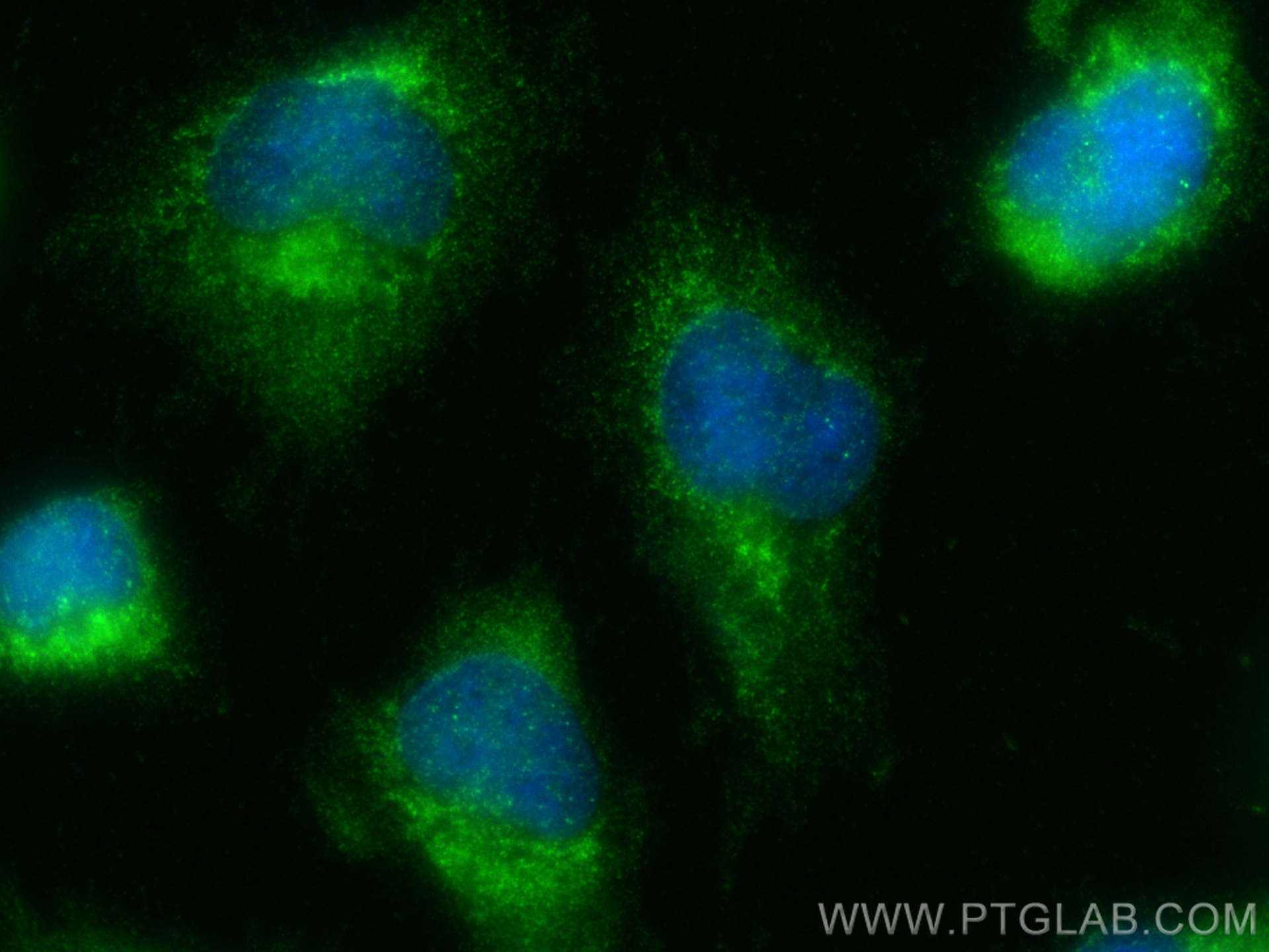 IF Staining of U-251 using 16711-1-AP