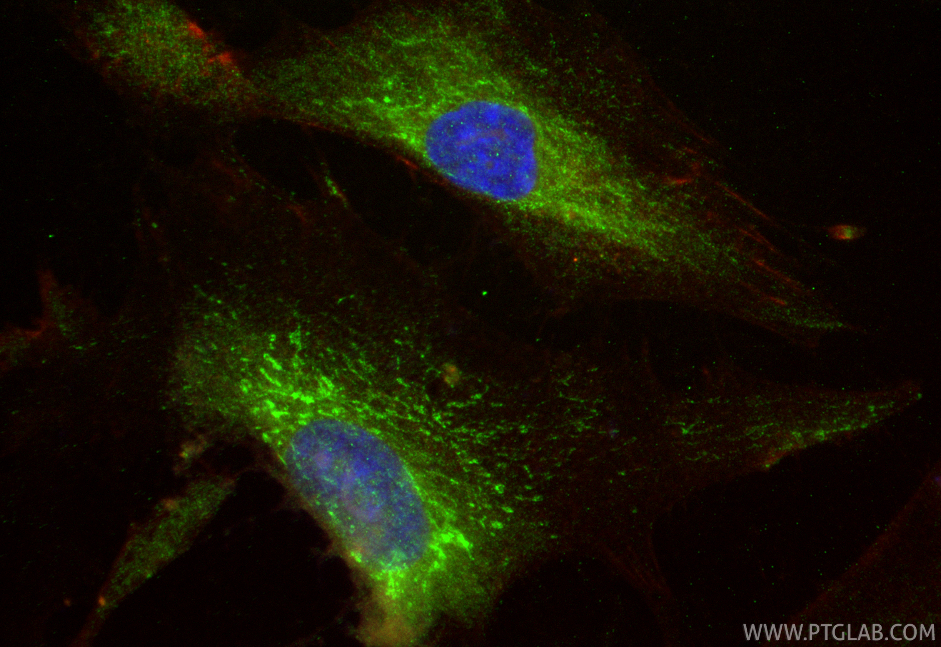 IF Staining of HSkMC using 16711-1-AP IF Staining of HSkMC using 16711-1-AP