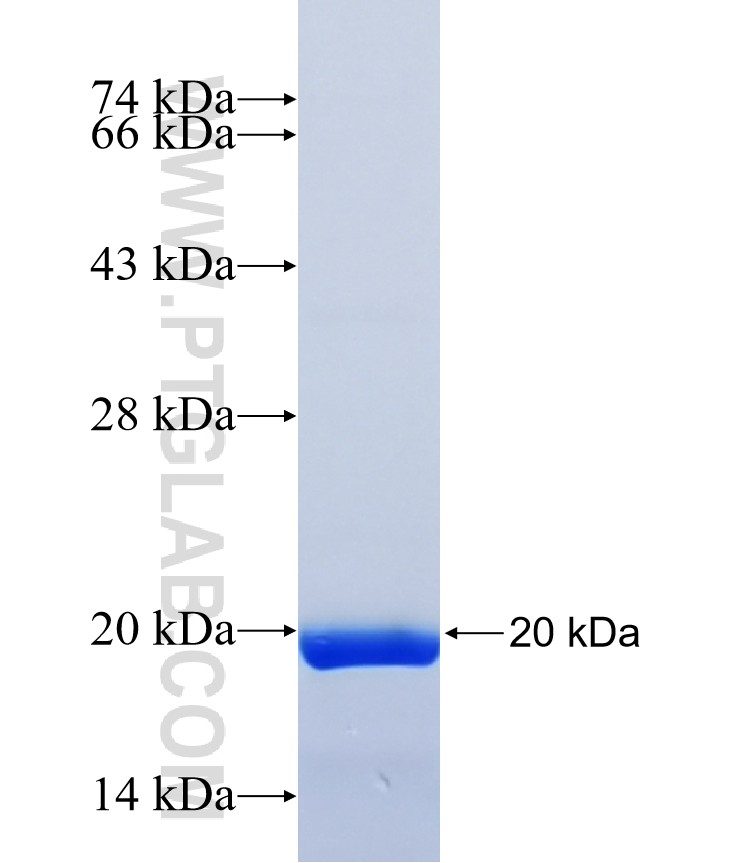 DMRT2 fusion protein Ag41154 SDS-PAGE DMRT2 fusion protein Ag41154 SDS-PAGE