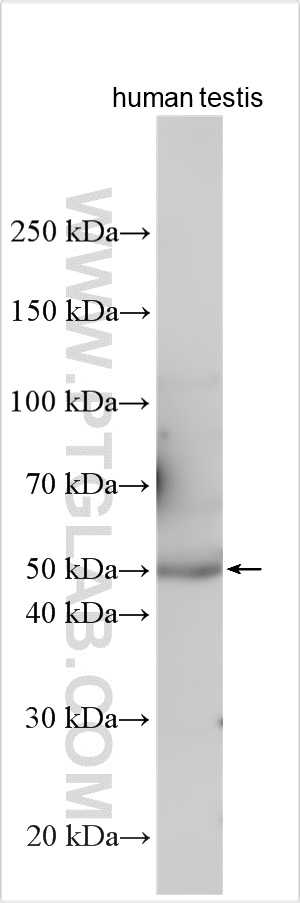 WB analysis using 26093-1-AP