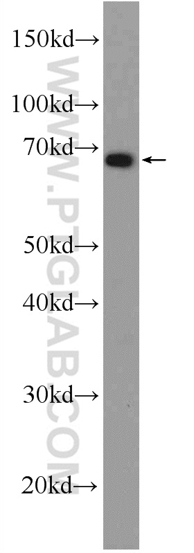 WB analysis of mouse liver using 24356-1-AP
