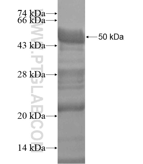 DMRTA1 fusion protein Ag18796 SDS-PAGE