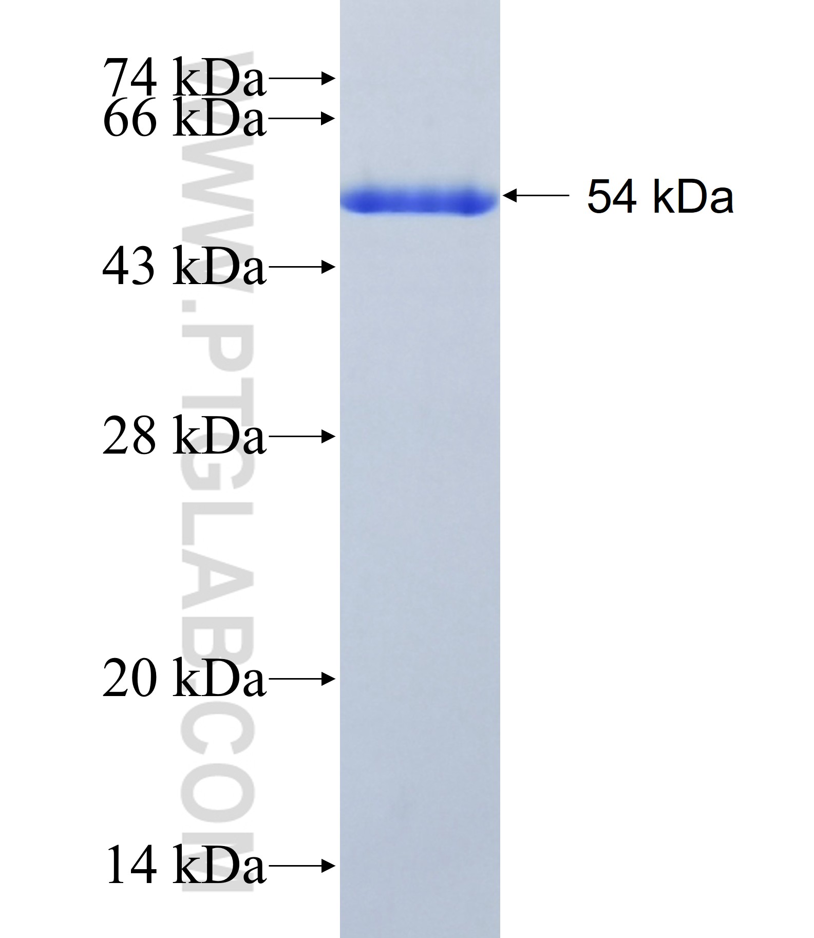 DMRTA2 fusion protein Ag41353 SDS-PAGE DMRTA2 fusion protein Ag41353 SDS-PAGE