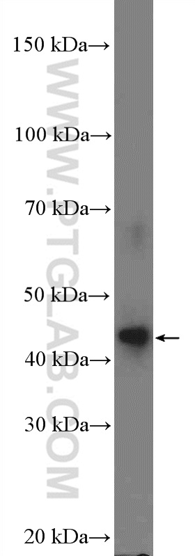 WB analysis of human testis using 26118-1-AP