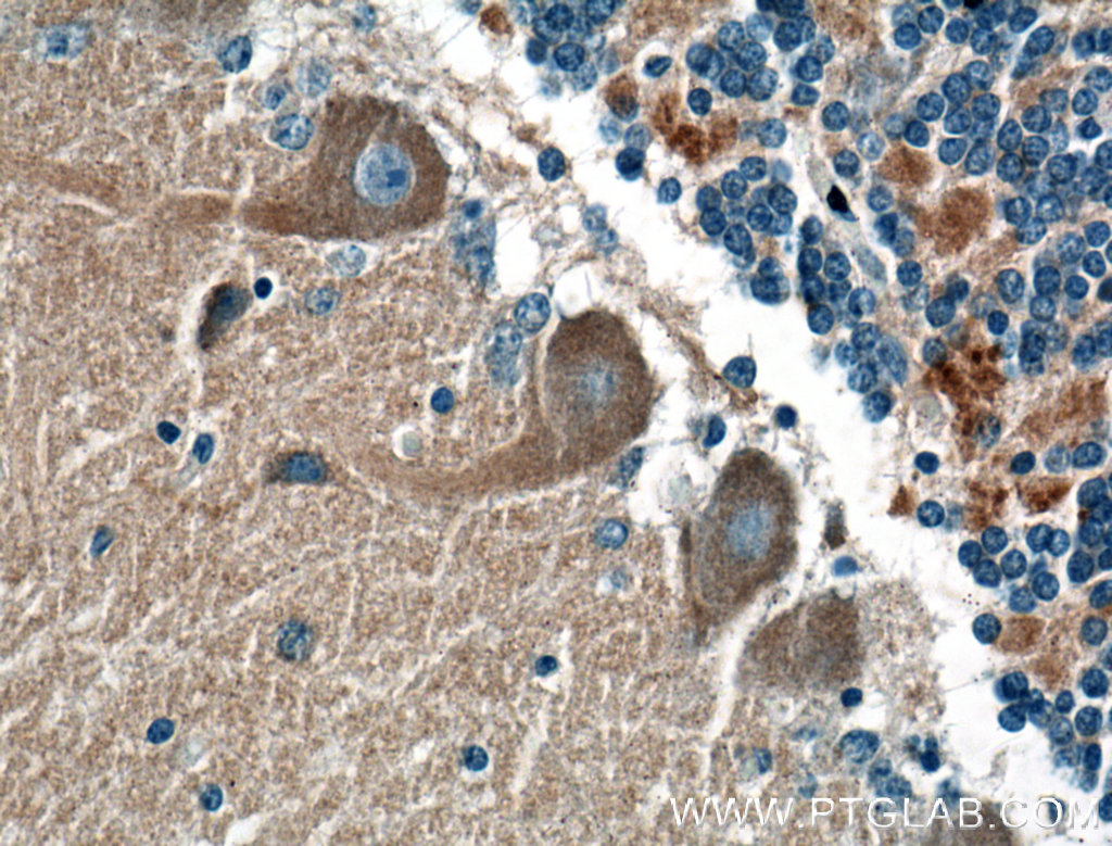 IHC staining of human cerebellum using 24415-1-AP