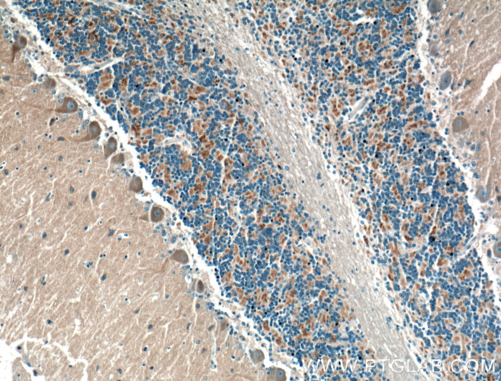 IHC staining of human cerebellum using 24415-1-AP