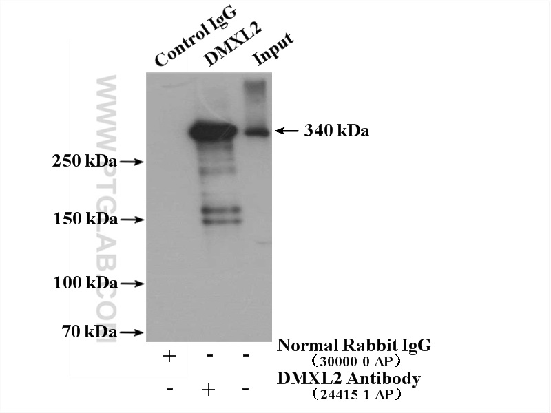 IP experiment of mouse brain using 24415-1-AP