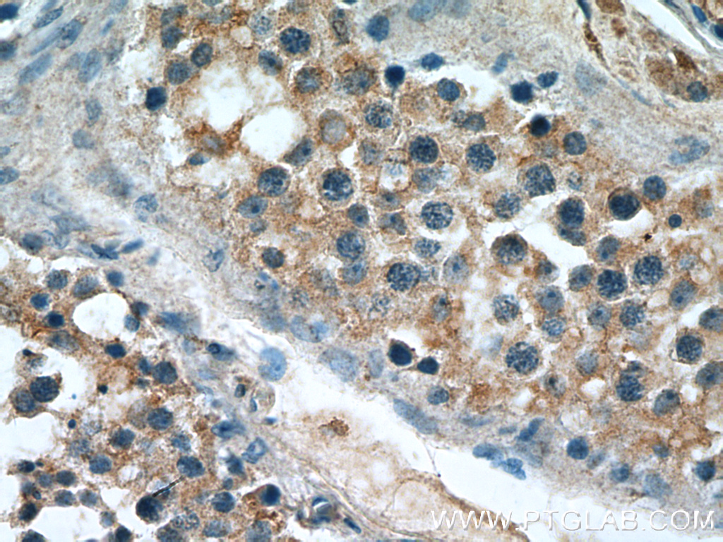 IHC staining of human testis using 27123-1-AP