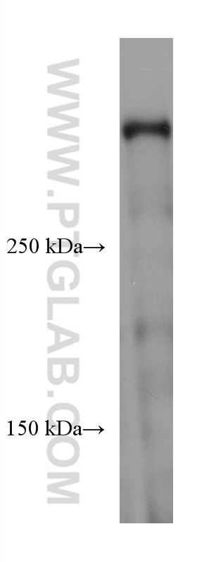 WB analysis of mouse cerebellum using 66891-2-Ig